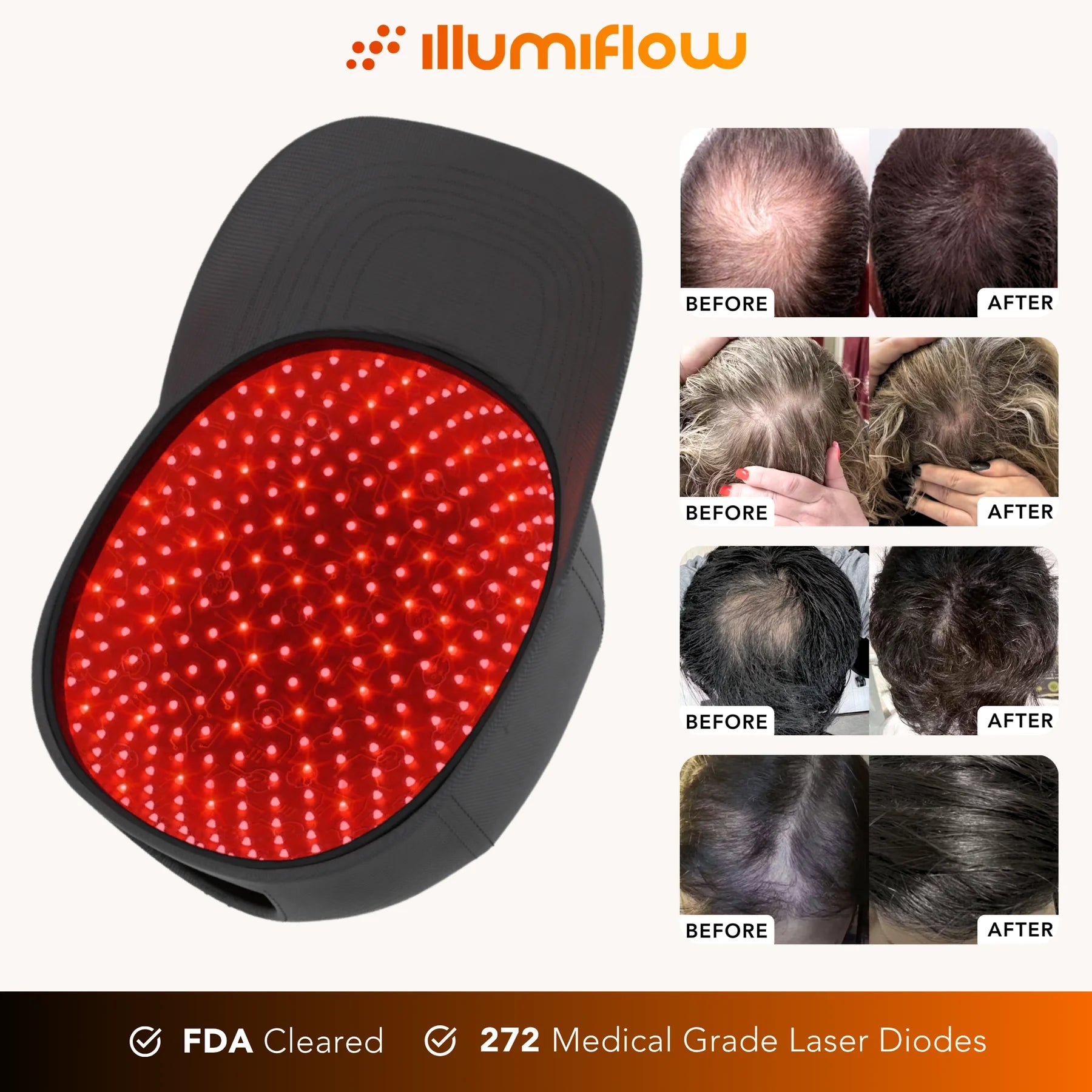 Red Light Hair Growth Cap